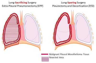 Lung images